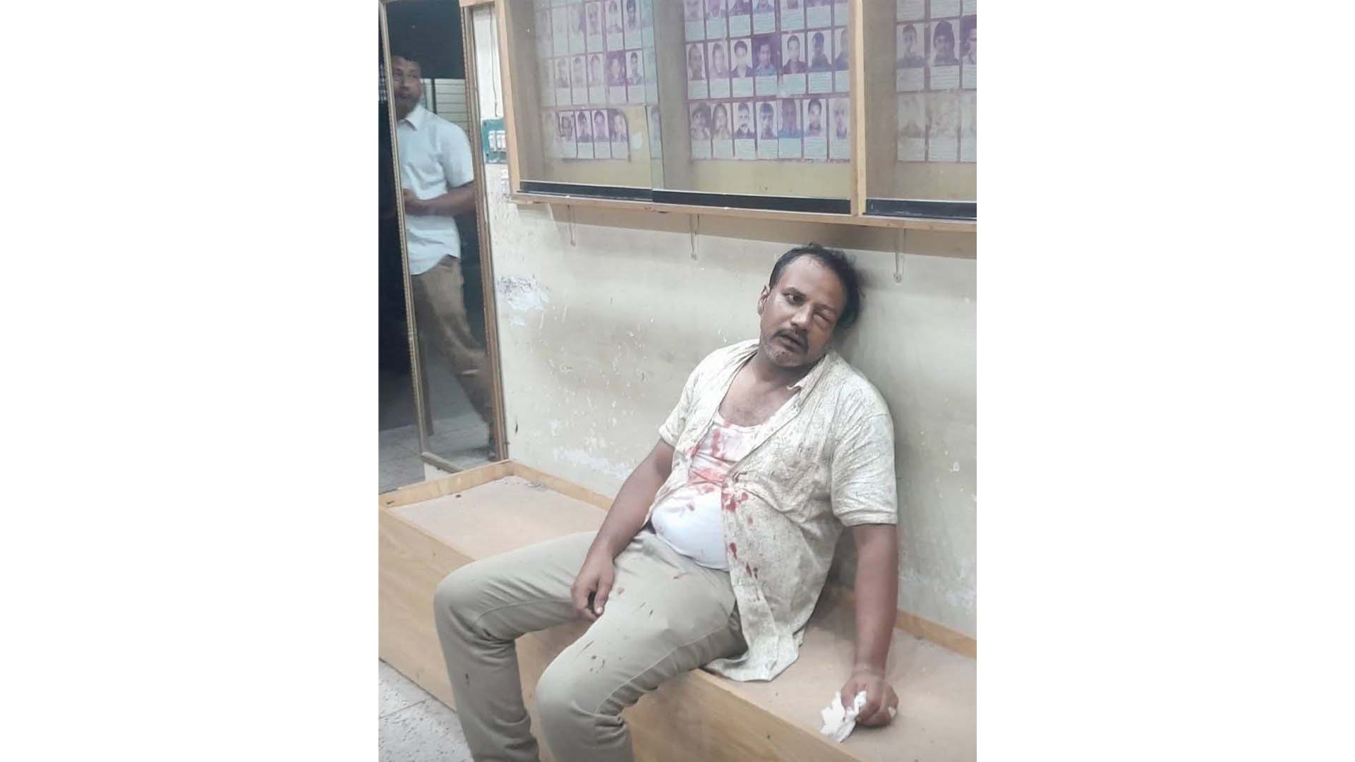 কোতয়ালী থানায় স্বেচ্ছাসেবক দল নেতাকে মারধরের অভিযোগ, রক্তাক্ত অবস্থায় হাসপাতালে